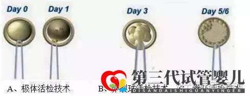 三代試管知男女的必經之路—胚胎活檢術(圖1) 三代試管知男女的必經之路—胚胎活檢術(圖1)