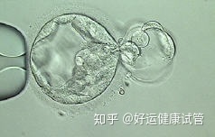 三代試管知男女的必經之路—胚胎活檢術(圖4) 三代試管知男女的必經之路—胚胎活檢術(圖4)