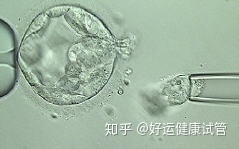 三代試管知男女的必經之路—胚胎活檢術(圖6) 三代試管知男女的必經之路—胚胎活檢術(圖6)