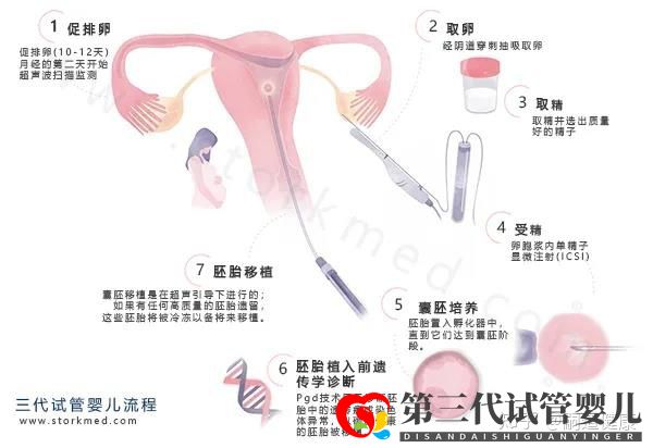 這張《第三代試管嬰兒流程圖》,一目了然(圖1) 這張《第三代試管嬰兒流程圖》,一目了然(圖1)