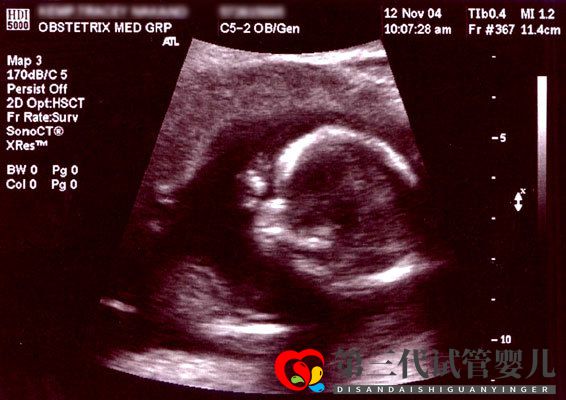 【三代試管嬰兒價格分享】2021做試管要花多少錢(圖3) 【三代試管嬰兒價格分享】2021做試管要花多少錢(圖3)