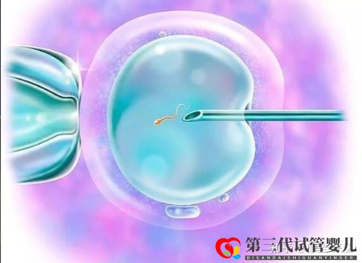 通俗易懂的一、二、三代試管嬰兒解說(圖2)