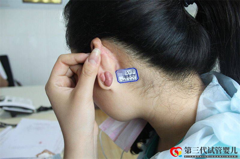 鄭州去疤痕的醫院哪家好(圖1)