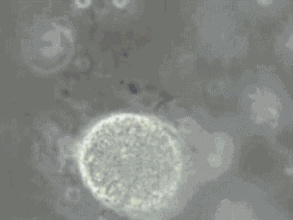 精子碎片率高可以做三代試管嬰兒嗎?(圖1) 精子碎片率高可以做三代試管嬰兒嗎?(圖1)