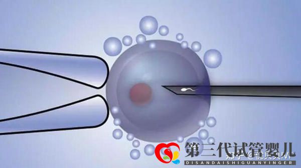 國內排名靠前的三代試管醫(yī)院都有哪些第一梯隊了解下(圖3)