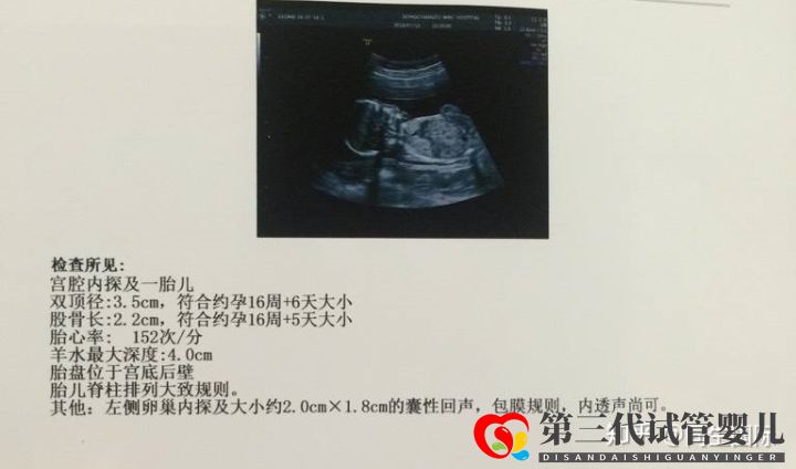 女人做了試管人就廢了其中的辛酸苦不堪言,但我不(圖2) 女人做了試管人就廢了其中的辛酸苦不堪言,但我不(圖2)