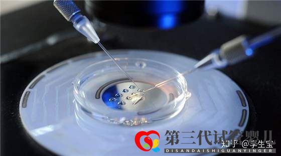 高齡做試管怎樣才能提高成功率(圖4) 高齡做試管怎樣才能提高成功率(圖4)