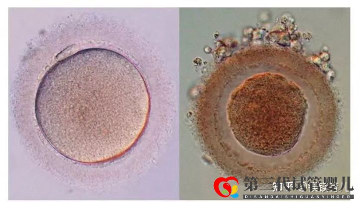 高齡女性試管多次失敗,應(yīng)該何去何從(圖1) 高齡女性試管多次失敗,應(yīng)該何去何從(圖1)