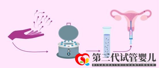 人授還是試管應該怎么選(圖1) 人授還是試管應該怎么選(圖1)