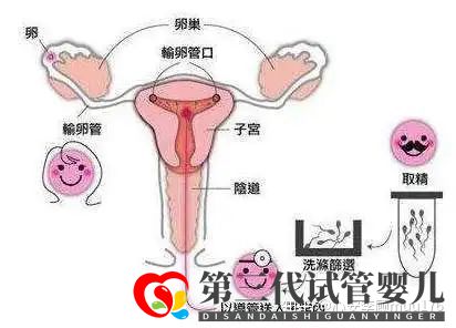 人工授精跟試管嬰兒的區別(圖5)