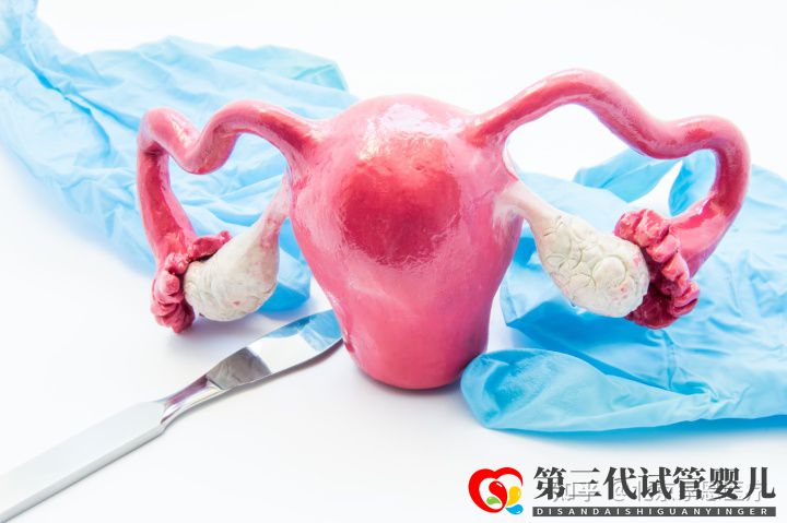 輸卵管堵塞是先疏通還是直接試管(圖1)