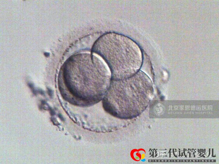 輸卵管堵塞是先疏通還是直接試管(圖4)