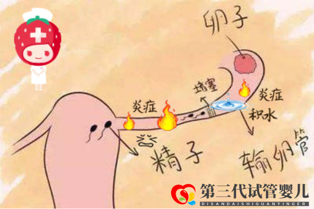 報喜萬家!輸卵管積水的她放棄做試管,卻憑一劑中藥喜獲“好孕”(圖1) 報喜萬家!輸卵管積水的她放棄做試管,卻憑一劑中藥喜獲“好孕”(圖1)