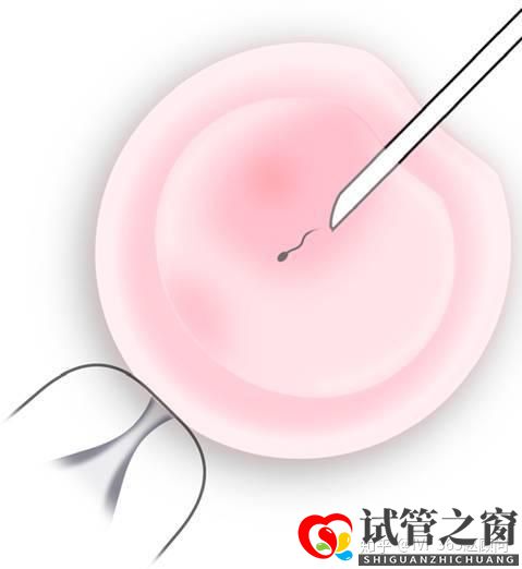 關于試管嬰兒,你想知道的都在這里,不懂就得多看看(圖1)
