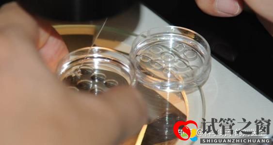 做試管嬰兒的全過程做三代試管嬰兒預備10萬夠不夠(圖1)