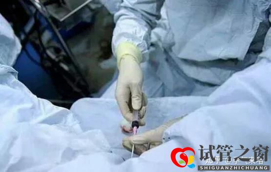 直擊試管嬰兒的過程(圖5) 直擊試管嬰兒的過程(圖5)