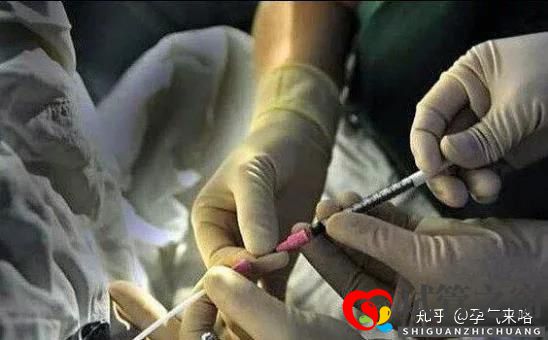 直擊試管嬰兒的過程(圖2) 直擊試管嬰兒的過程(圖2)