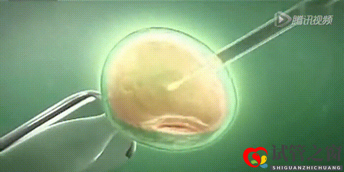 哪些人群需要做供卵試管嬰兒？(圖2)