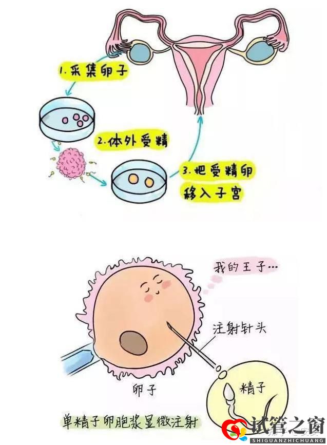 “試管嬰兒又不是親生的,多丟人”(圖1) “試管嬰兒又不是親生的,多丟人”(圖1)