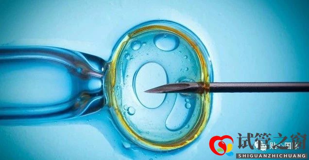 試管嬰兒4大流程，讓你了解它究竟是什么(圖1)