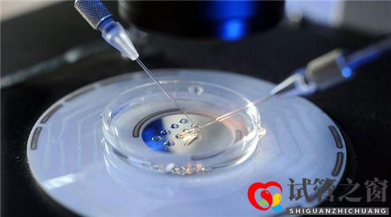 多囊卵巢綜合癥能做試管嬰兒嗎(圖1)