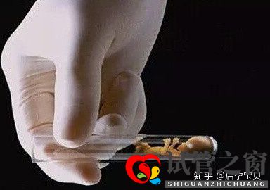 靠試管嬰兒生寶寶首先要滿足6個標準(試管嬰兒怎么做的全過程)(圖2) 靠試管嬰兒生寶寶首先要滿足6個標準(試管嬰兒怎么做的全過程)(圖2)