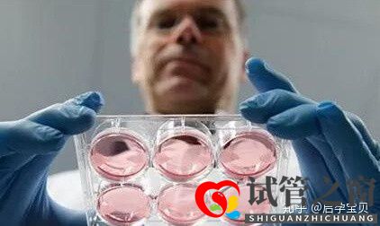 靠試管嬰兒生寶寶首先要滿足6個標準(試管嬰兒怎么做的全過程)(圖4) 靠試管嬰兒生寶寶首先要滿足6個標準(試管嬰兒怎么做的全過程)(圖4)