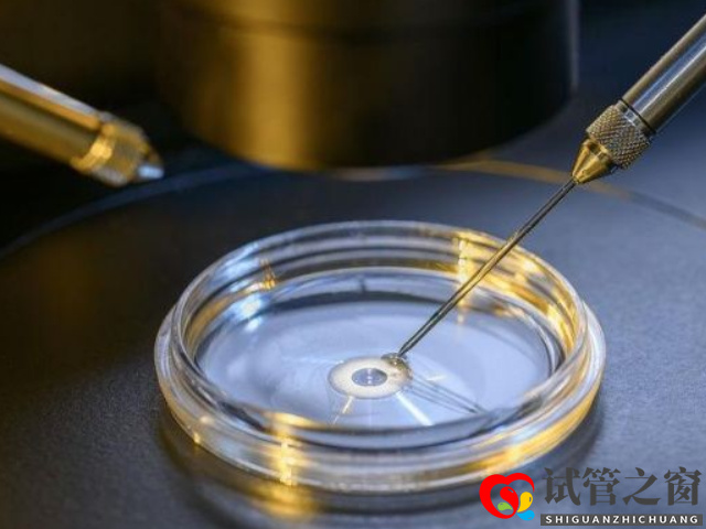 無精癥做二代試管成功案例分享,從“一無所有”到“無中生有“(圖3) 無精癥做試管成功率在30%左右