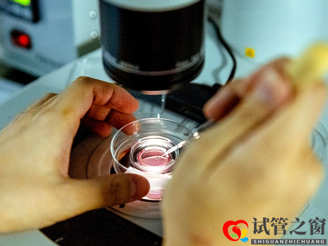 無精癥比死精癥嚴重