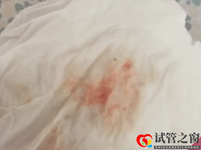 取卵后出現少量出血為正?，F象