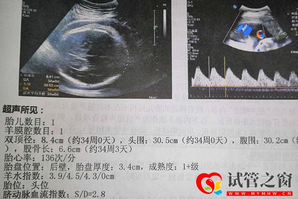 解讀試管移植一、二、三超檢查,按時(shí)過了二超也并非安全(圖2) 試管嬰兒一超確定胎兒是否宮內(nèi)妊娠