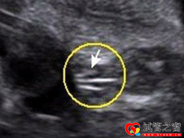 女寶b超圖三條線