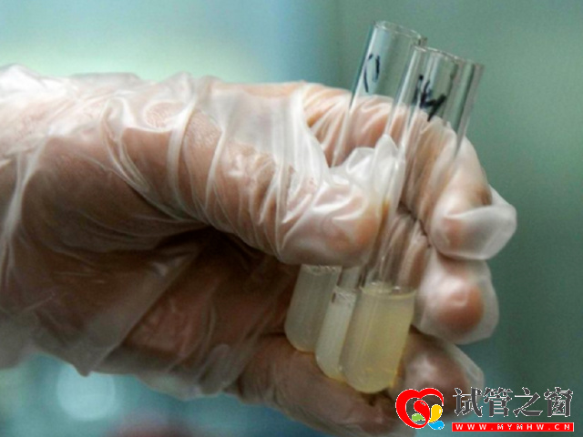 正常男性精子顏色對照表,發黃發紅都要警惕起來(圖2) 精子顏色為灰白或者是淡黃色的