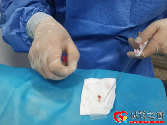 睪丸穿刺是經(jīng)過皮膚對睪丸進(jìn)行穿刺