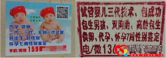 性別鑒定、包生男女三代試管「亂象」緣何產生(圖5) 性別鑒定、包生男女三代試管「亂象」緣何產生(圖5)