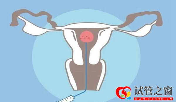 進(jìn)行三代試管嬰兒會(huì)有什么風(fēng)險(xiǎn)嗎(圖3)