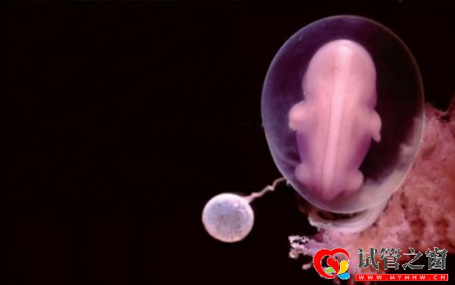 每年有30萬名試管嬰兒誕生!費用要10萬起效果卻因人而異(圖3)