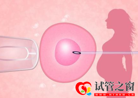 三代試管的促排方案有很多種,要怎么選擇?(圖1) 三代試管的促排方案有很多種,要怎么選擇?(圖1)