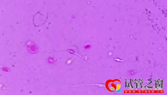三分鐘教你分辨死精和弱精(圖3)