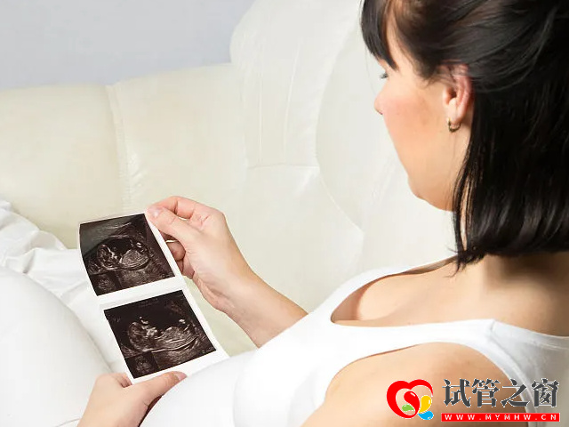 四維彩超看男孩女孩訣竅