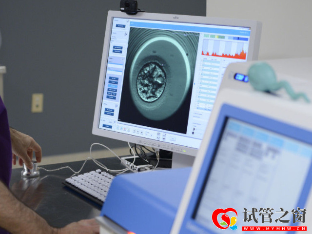 國內(nèi)男性hiv攜帶者精子洗滌試管費用明細,讓你寶寶更健康!(圖3) 囊胚篩查費在40000元左右