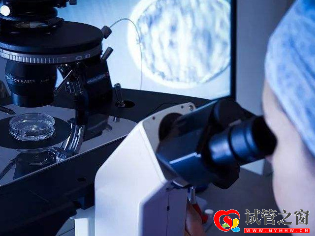 黃體期促排方案優缺點盤點,卵巢功能差提高獲卵數就靠它(圖2) 黃體期促排使用患者會經歷兩次取卵