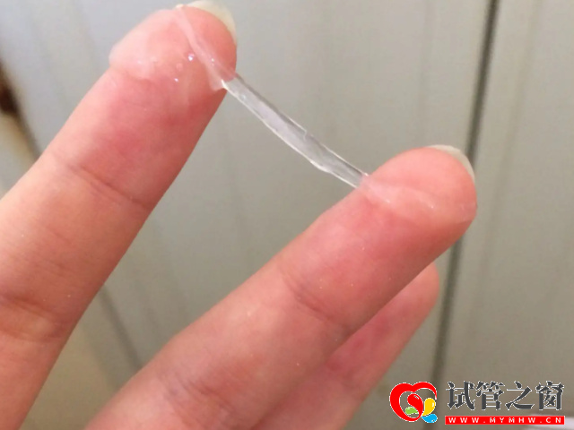 排卵期白帶拉絲