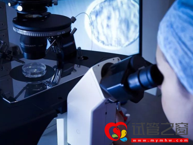 國內(nèi)已婚女性凍卵前期準(zhǔn)備須知,不滿足條件就不要想了(圖3) 取卵手術(shù)大概15至20分鐘