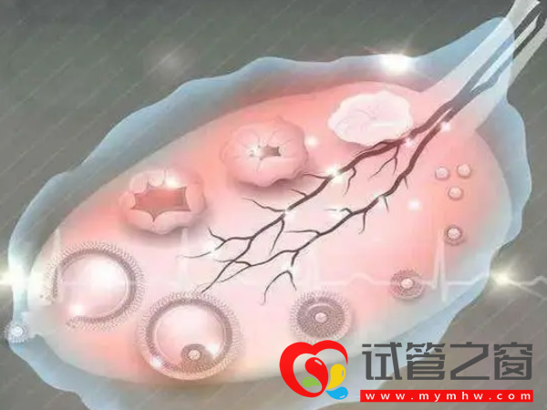 B超查空卵泡準確率并不高!如何能查出方法有三種(圖2) 空跑卵取出卵子可查出