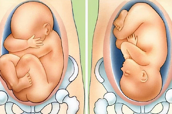 胎兒頭位可能是男寶