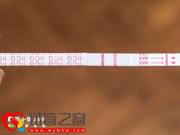 試管移植后老打嗝怎么回事