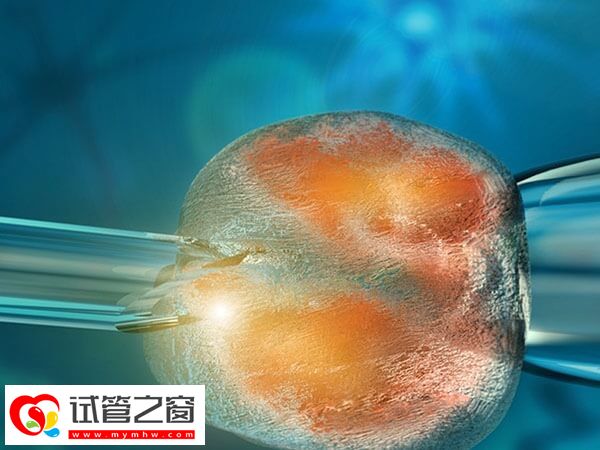 無麻藥取卵親身經歷分享,全程十幾分鐘痛感并不明顯(圖1) 不打麻藥取卵會不會很難受