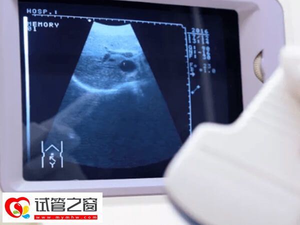 試管嬰兒操作過程