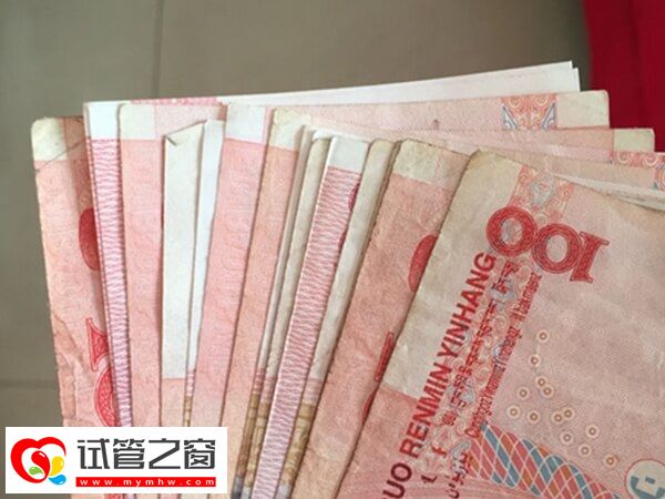 節約試管費用的方法